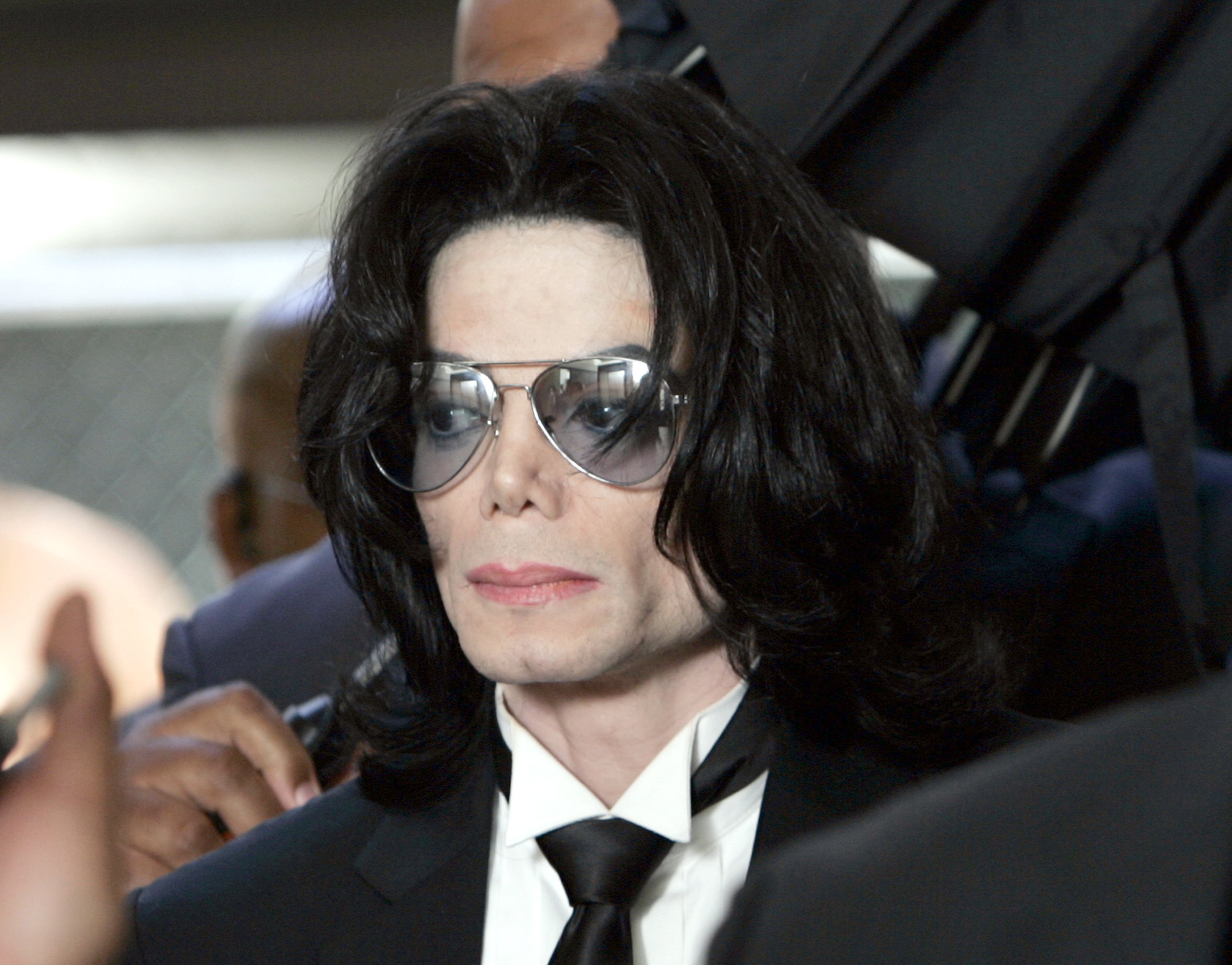 Michael Jackson s Skin Condition Rumors Were Finally Put to Rest