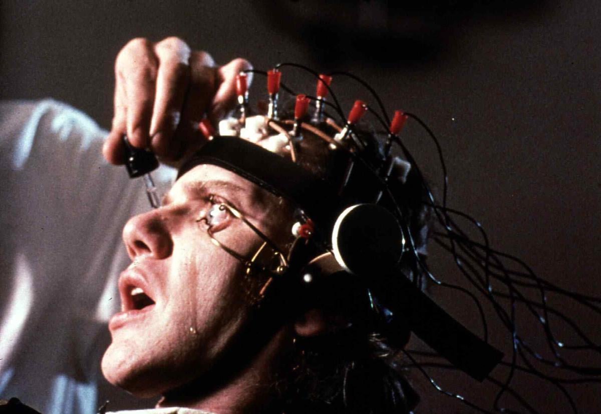 A Clockwork Orange Malcolm Mcdowell Sliced His Cornea And Went Temporarily Blind While 