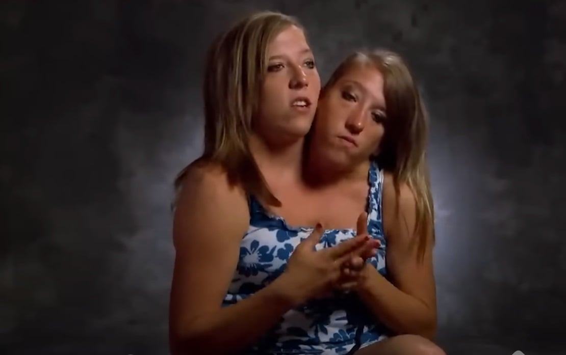 Abby and Brittany Hensel appear in a TV special